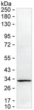 C1QTNF1